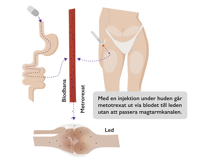 Reumatiska sjukdomar behandling