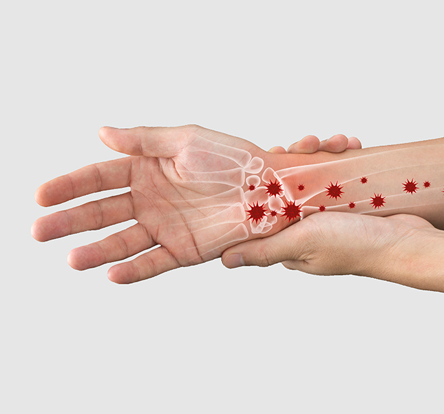 Reumatiska sjukdomar symtom